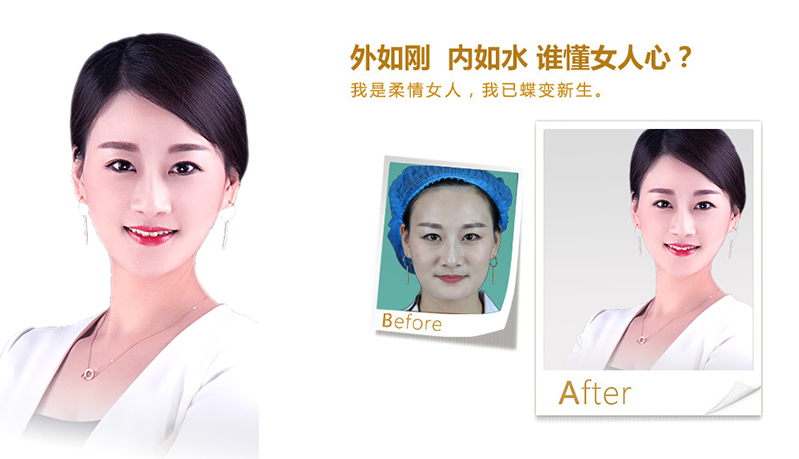 盘锦V脸、线雕隆鼻